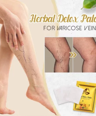 Varicose Veins को लागी हर्बल Detox प्याच