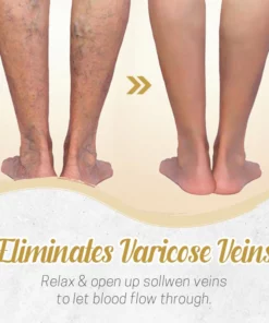 Herbal Detox Patch for Varicose Veins