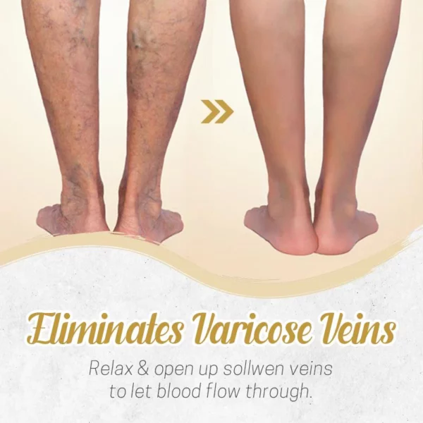 Herbal Detox Patch para sa Varicose Veins