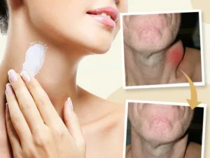 Lymphedem™ Detoxification Cream