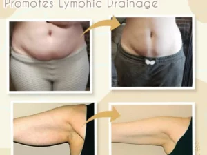Lymphedem™ Detoxification Cream