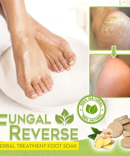 Fungal Reverse Herbal Treatment Foot Soak