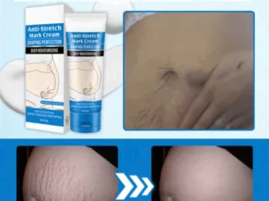 Striae Off™ Anti-Stretch Mark Cream
