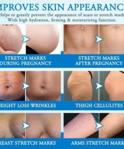 Striae Off™ Anti-Stretch Mark Cream