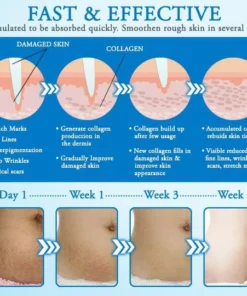 Striae Off™ Anti-Stretch Mark Cream