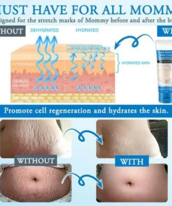 Striae Off™ Anti-Stretch Mark Cream