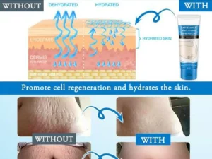 Striae Off™ Anti-Stretch Mark Cream