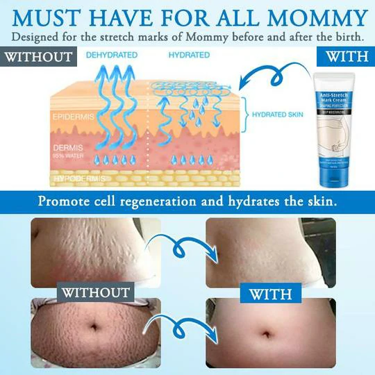 Striae Off™ Anti-Stretch Mark Cream