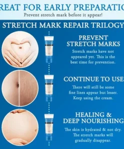 Striae Off™ Anti-Stretch Mark Cream