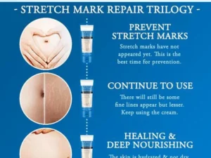Striae Off™ Anti-Stretch Mark Cream