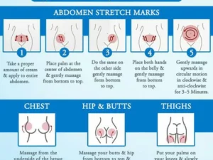 Striae Off™ Anti-Stretch Mark Cream