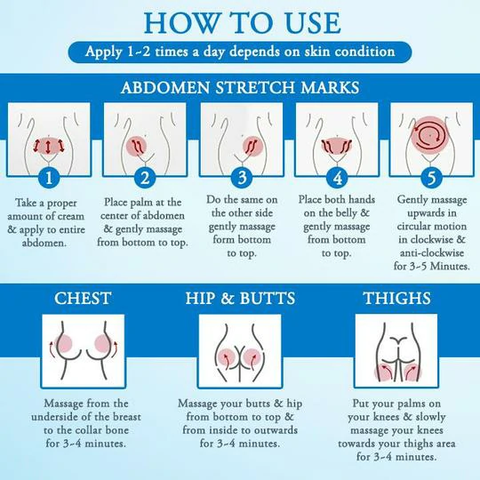 Crema antiestrías Striae Off™