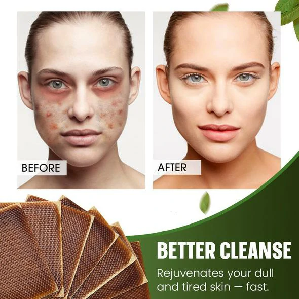 Bản vá giải độc CleanseComplex