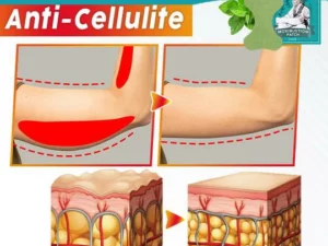 Burn-FAT Arm Slimming Moxibustion Patch (12PCS)