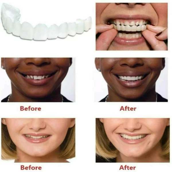 Nchekwa Ọhụrụ Plus Snap-Na Dentures