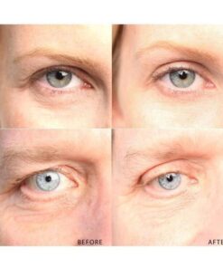 (🎅 EARLY XMAS SALE - Save 50% OFF) New 2021 Instant Eye Lift