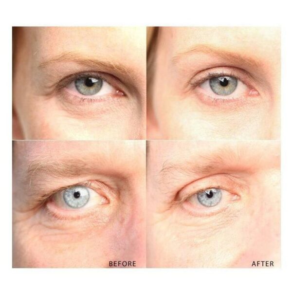 (🎅 EARLY XMAS SALE - Save 50% OFF) New 2021 Instant Eye Lift