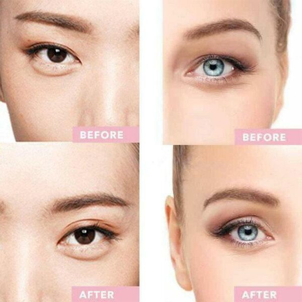(🎅 EARLY XMAS SALE - Save 50% OFF) ថ្មី 2021 Instant Eye Lift