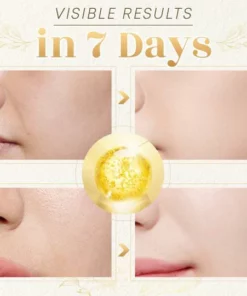 Line-Rescue Golden Collagen Peptide Kit