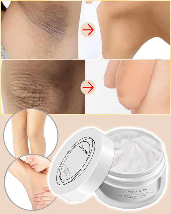 (Early Mother's Day Hot Sale-48% OFF)💖Ultimate Body Whitening Cream(Buy 2 get 1 free now!))