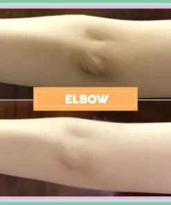 (Early Mother's Day Hot Sale-48% OFF)💖Ultimate Body Whitening Cream(Buy 2 get 1 free now!))