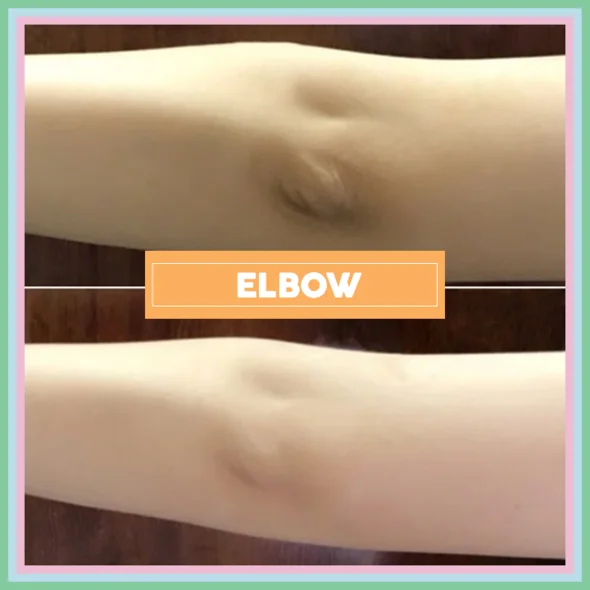 (Early Mother's Day Hot Sale-48% OFF)💖Ultimate Body Whitening Cream(Buy 2 get 1 free now!))