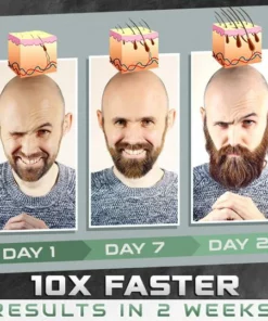 BeardBorn™ Growth Spray