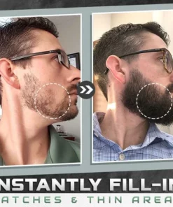 BeardBorn™ Growth Spray