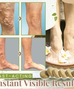 HerbsCure™ Anti-Varicose Veins Foot Soak
