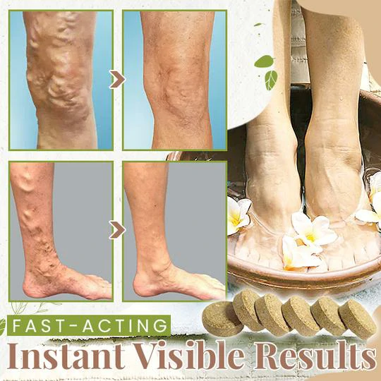 HerbsCure™ Anti-Varicose Veins Foot Soak