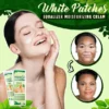 White Patches Equalizer Moisturizing Cream