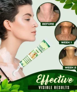 White Patches Equalizer Moisturizing Cream