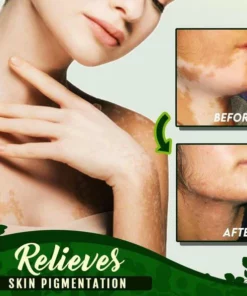 White Patches Equalizer Moisturizing Cream