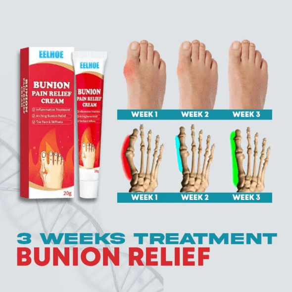 Bunion Relief Ointment Cream