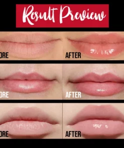 💋5 Mins Extreme Lip Plumper