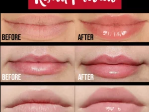 💋5 Mins Extreme Lip Plumper