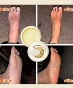 🎅NEW YEAR 2022 SALE - 49%OFF🔥🔥🔥100% Natural&Winter Anti-Cracking Frost