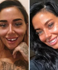 THE WHITEBRIGHT SNAP ON SMILE