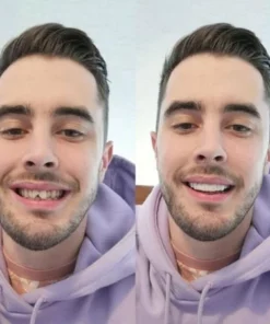 THE WHITEBRIGHT SNAP ON SMILE