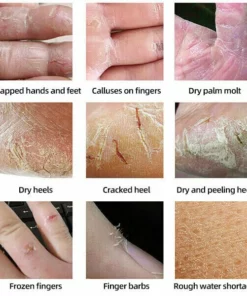 🎅NEW YEAR 2022 SALE - 49%OFF🔥🔥🔥100% Natural&Winter Anti-Cracking Frost