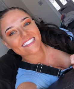 EVINGA™ PERFECT SMILE VENEERS