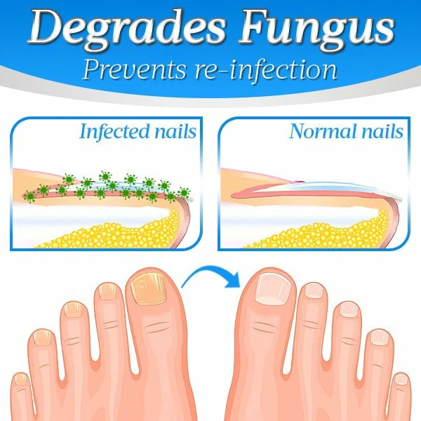 Nailthy™ Fungus Nail Repair Gel