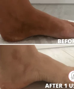 🔥Hot Sale -50% OFF 🔥-SkinSolutions Exfoliating Glove-Best Gift