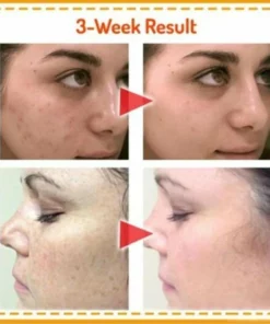 Vitamin SkinCorrector Ampoule Vitamin SkinCorrector Ampoule Vitamin SkinCorrector Ampoule Vitamin SkinCorrector Ampoule Vitamin SkinCorrector Ampoule Vitamin SkinCorrector Ampoule Vitamin SkinCorrector Ampoule Vitamin SkinCorrector Ampoule Vitamin SkinCorrector Ampoule Vitamin SkinCorrector Ampoule Vitamin SkinCorrector Ampoule Vitamin SkinCorrector Ampoule Vitamin SkinCorrector Ampoule Vitamin SkinCorrector Ampoule