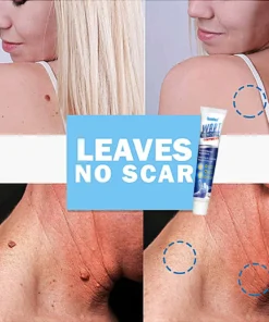 🔥BUY 1 GET 1 FREE🔥Instant Blemish Removal Gel