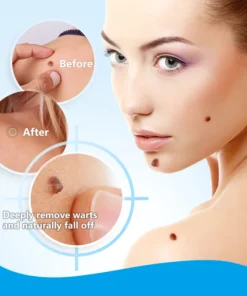 🔥BUY 1 GET 1 FREE🔥Instant Blemish Removal Gel