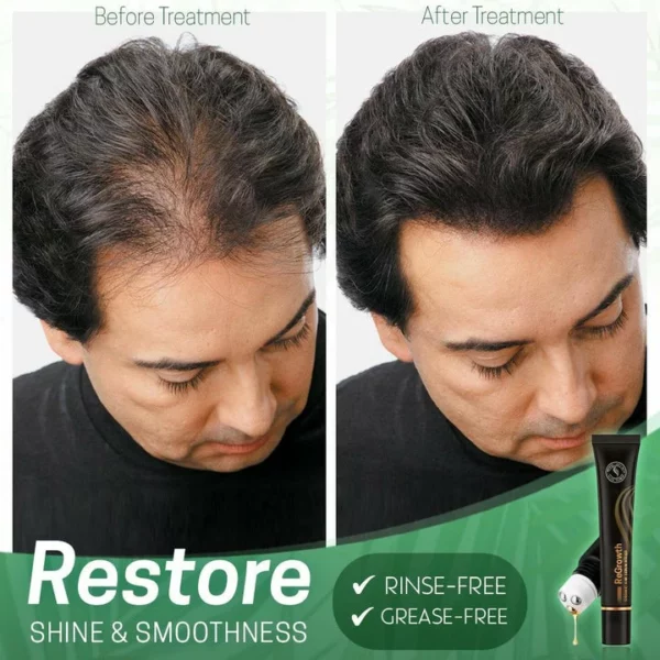 Rullo di siero per capelli biologico Regrowth™