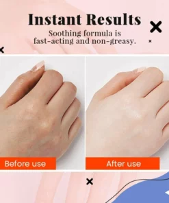 Hot Sale Hyaluronic Acid Hand Care Essence