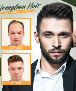 7 Day Herb Germinal Serum（Limited time discount 🔥 last day）