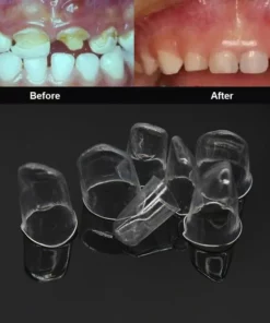 64pcs Dental Anterior Transparent Crowns